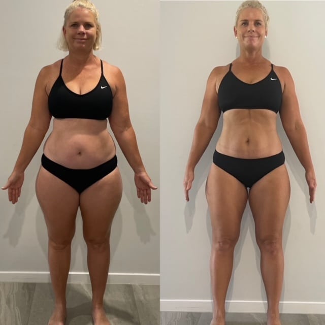 Patient transformation — Bluewater Medical weight loss program in Snoqualmie, Bellevue, and greater Seattle