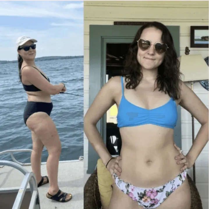 Patient #2 weight loss transformation — before and after Bluewater Medical program