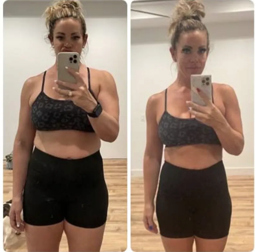 Patient #1 weight loss transformation — before and after Bluewater Medical GLP-1 program