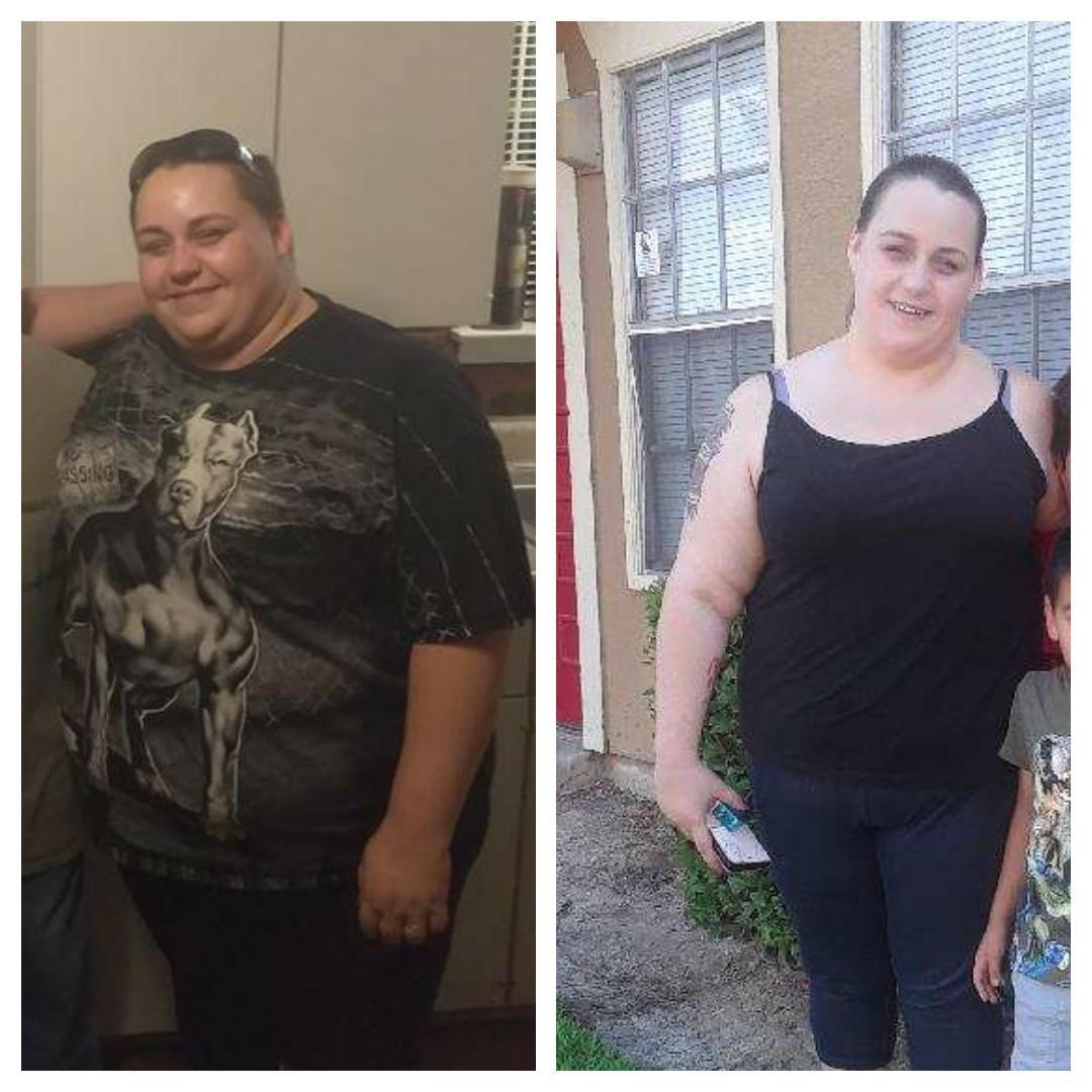 Patient #3 weight loss transformation — before and after Bluewater Medical program